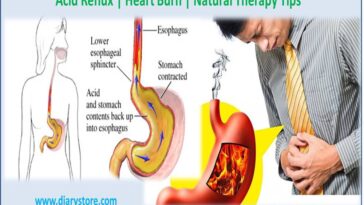 How do you calm acid reflux?