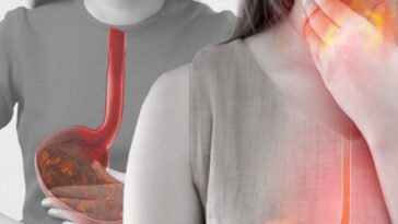 How do you cure GERD permanently?