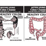 How do you flush your intestines?