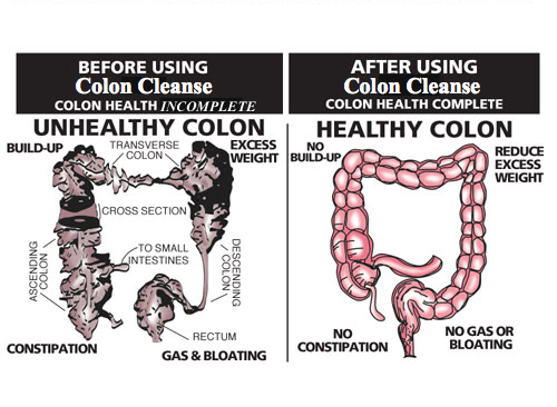 How do you flush your intestines?