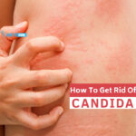 How do you get rid of Candida weight?