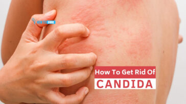 How do you get rid of Candida weight?