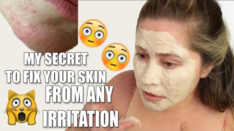 How do you get rid of an allergic reaction on face mask?