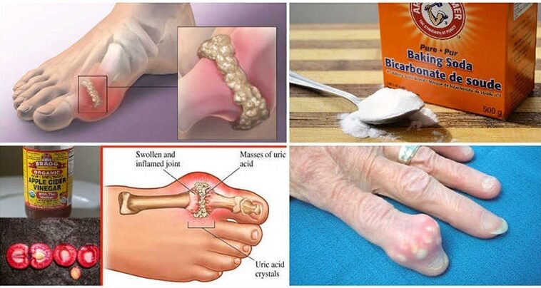 How do you remove acid from your body?