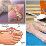 How do you remove acid from your body?