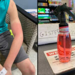 How do you treat a chemical burn from a sanitizer?