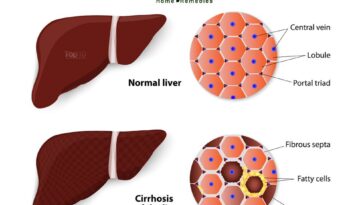 How does coffee affect the liver?