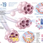 How does the coronavirus affect our body?