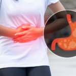 How does yogurt affect bowel movements?