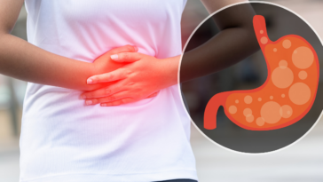 How does yogurt affect bowel movements?