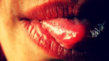 How long does it take for burnt taste buds to heal?