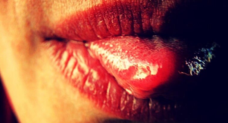 How long does it take for burnt taste buds to heal?
