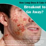 How long does it take inflammation to go away?