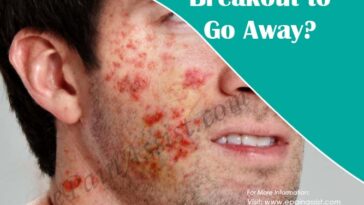 How long does it take inflammation to go away?