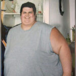 How much can a morbidly obese person lose in a month?