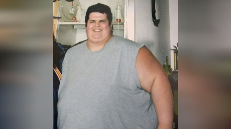 How much can a morbidly obese person lose in a month?