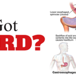 Is Jelly okay for acid reflux?