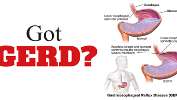 Is Jelly okay for acid reflux?
