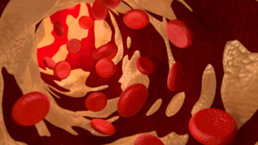 Is LDL 109 high cholesterol?