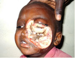 Is Noma really that good?