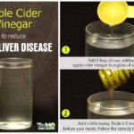Is apple cider vinegar good for your liver?