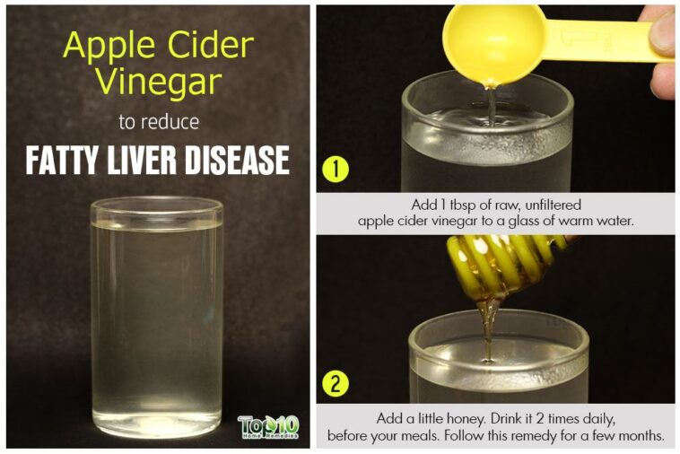 Is apple cider vinegar good for your liver?