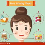 Is chips can cause acne?