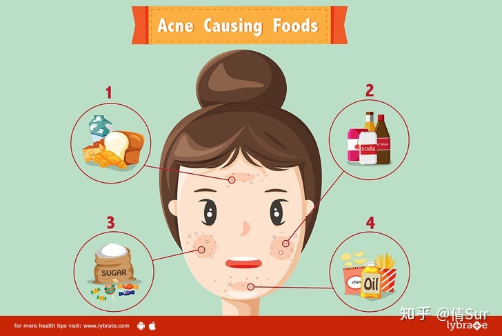 Is chips can cause acne?