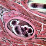 Is trichinosis still a problem with pork?