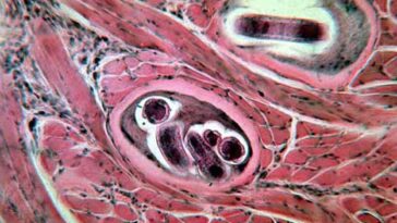 Is trichinosis still a problem with pork?