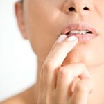 Should I keep my cold sore moist or dry?