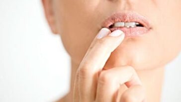 Should I keep my cold sore moist or dry?