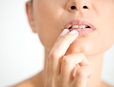 Should I keep my cold sore moist or dry?