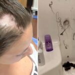 What am I lacking if my hair is falling out?