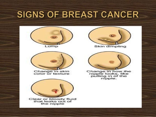 What are breasts meant to feel like?