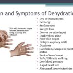 What are the 10 signs of dehydration?