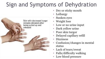 What are the 10 signs of dehydration?