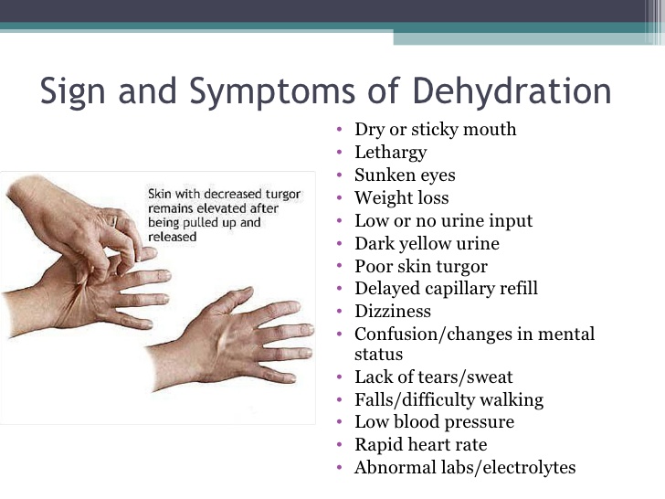 What are the 10 signs of dehydration?