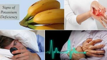 What are the 10 signs of low potassium?