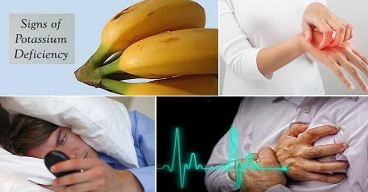 What are the 10 signs of low potassium?