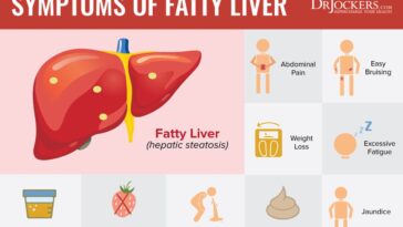 What are the 3 signs of a fatty liver?