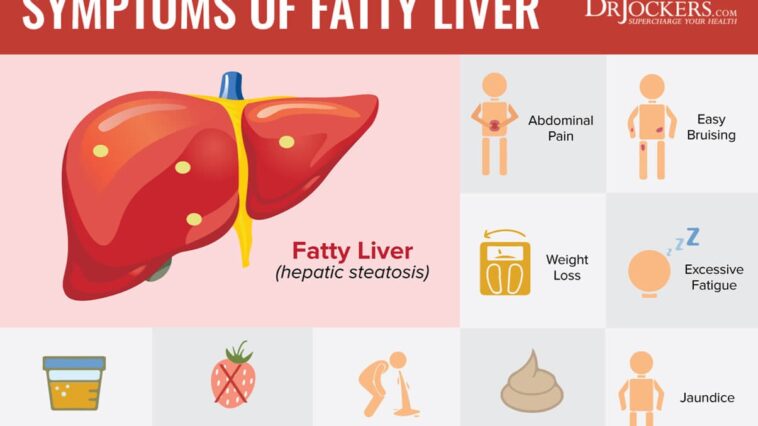 What are the 3 signs of a fatty liver?