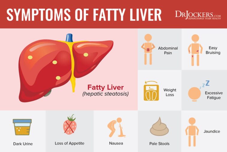What are the 3 signs of a fatty liver?