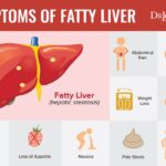 What are the 3 signs of a fatty liver?