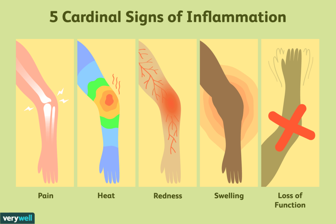 what-are-the-5-classic-signs-of-inflammation