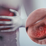 What are the symptoms of stomach shrinking?