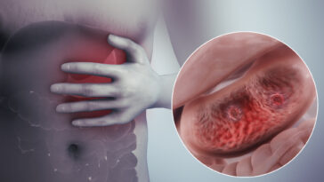 What are the symptoms of stomach shrinking?