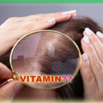 What are you lacking when your hair falls out?