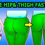 What causes hip and thigh fat?