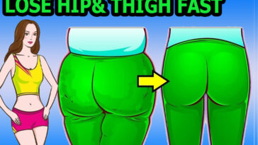 What causes hip and thigh fat?